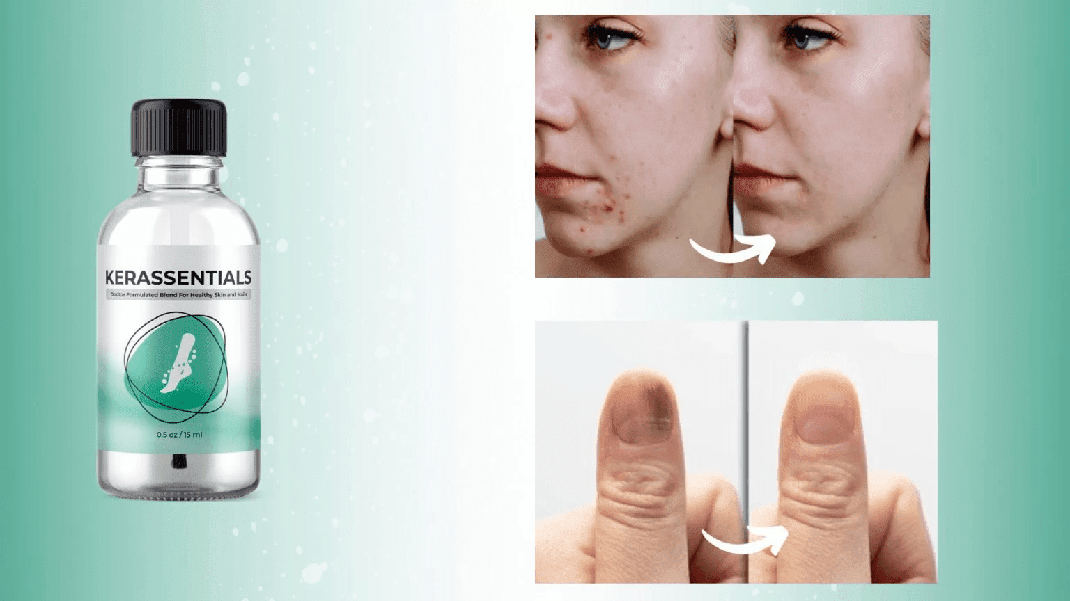 Kerassentials product Kerassentials